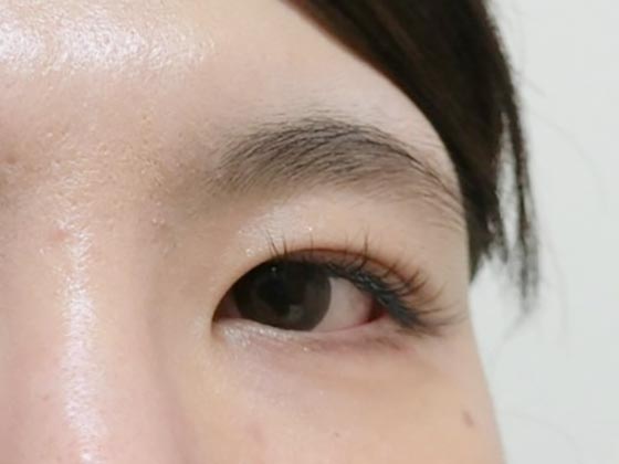 施術前