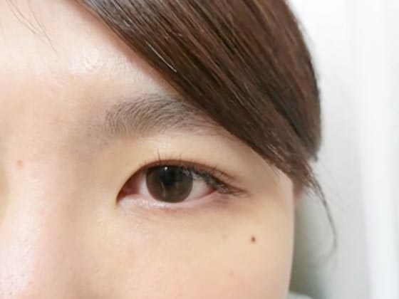 施術後